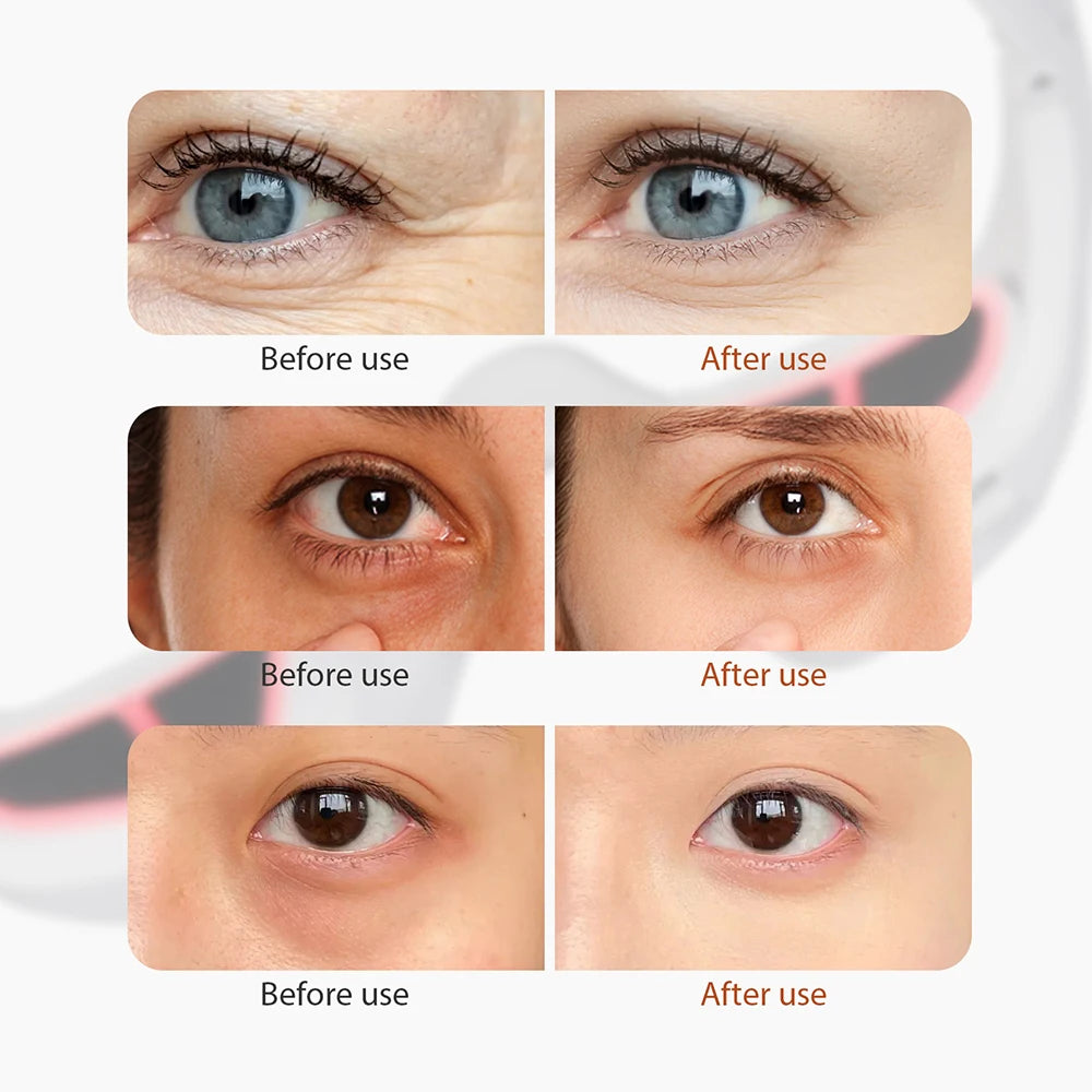 EyeDra – Slimme ontspanning voor vermoeide ogen